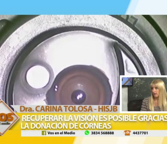 Dra. Carina Toloza: Donación y trasplante de corneas
