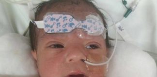 Intervienen quirúgicamente al pequeño Nehitan