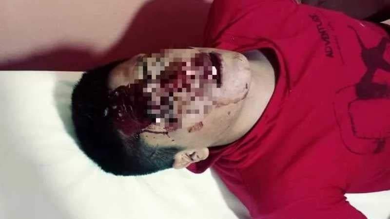 Agredido en belén