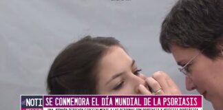 Se conmemoró el día mundial de la psoriasis